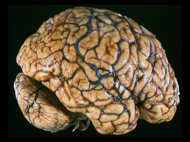 brain.jpg